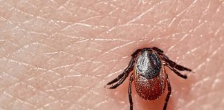 Tick on human skin. Photo/Shutterstock.