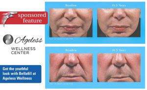 Get the youthful look with Bellafill at Ageless ...